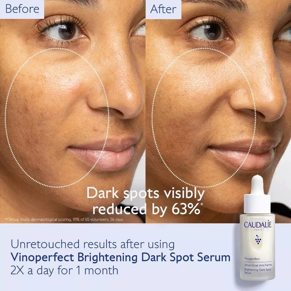Caudalie Vinoperfect Brightening Dark Spot Serum Vitamin C